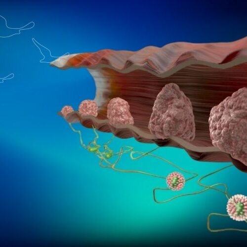 klinist- anal hpv taraması klinist- anal hpv taraması