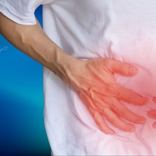 klinist- crohn fistülleri klinist- crohn fistülleri
