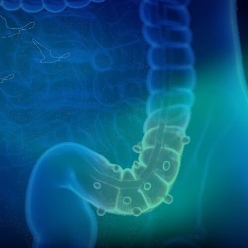 klinist- divertiküler hastalık tedavisi