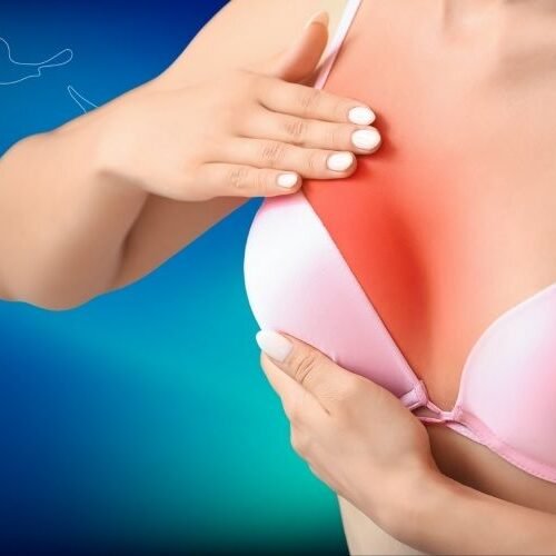 klinist- lohusa mastiti