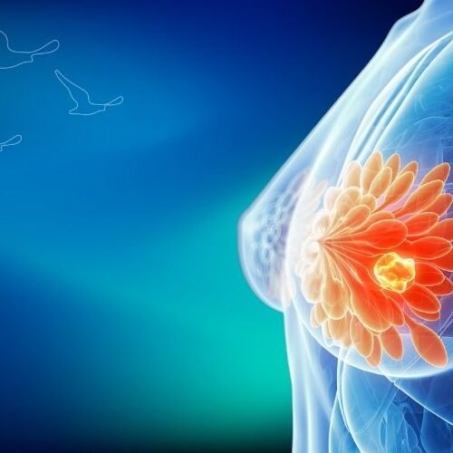 klinist- meme kanseri taraması