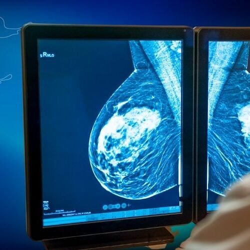 klinist- meme muayenesi, rutin meme kontrolleri