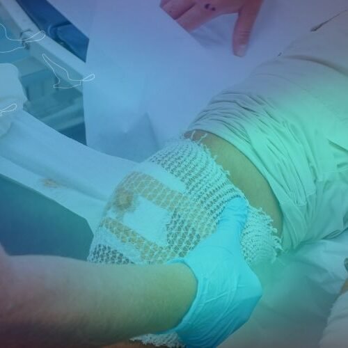 klinist- yara bakımı klinist- yara bakımı