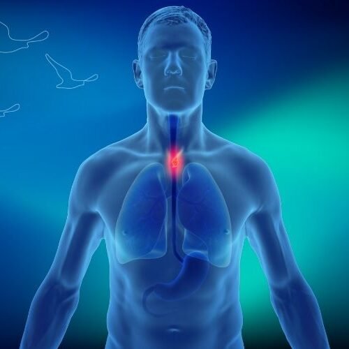 klinist- yemek borusu kanseri