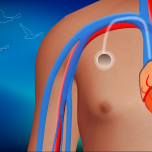 Klinist - Kemoterapi Portu