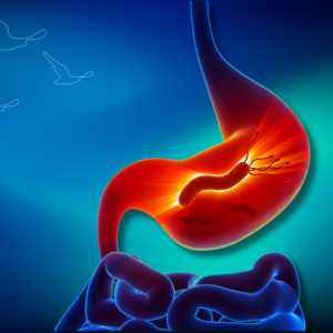 Klinist - Mide Kanseri