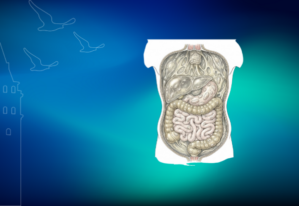 Psödomiksoma Peritonei Psödomiksoma Peritonei