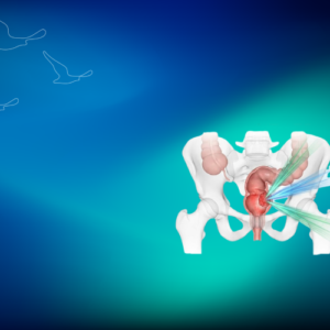 Rektum kanseri ameliyatsız tedavi