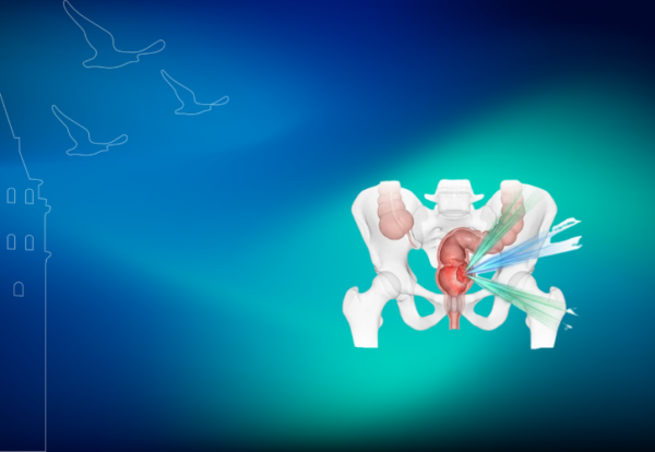 Rektum kanseri ameliyatsız tedavi Rektum kanseri ameliyatsız tedavi