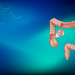 Kolon Kanserinden Korunma Yolları | Erken Teşhis ve Tarama Rehberi  | Klinist