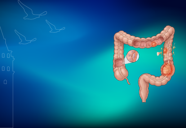 Kolon kanseri-klinist