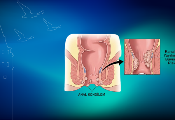 anal siğiller